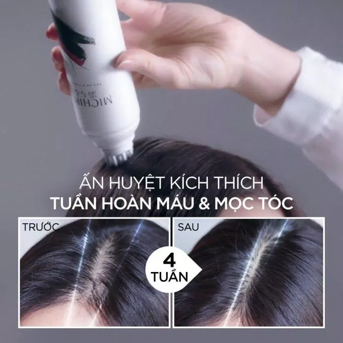 Tinh chất Michiru Hair Growth Tonic giúp giảm hẳn tình trạng rụng tóc sau khoảng 5-6 lần sử dụng (Nguồn: Internet).
