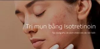 Trị mụn bằng Isotretinoin: Tác dụng phụ và cách chăm sóc da bạn cần biết