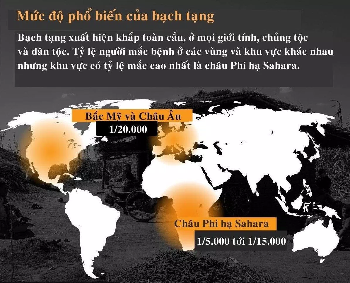 Bạch tạng có thể ảnh hưởng đến mọi người thuộc mọi chủng tộc (Ảnh: Internet).