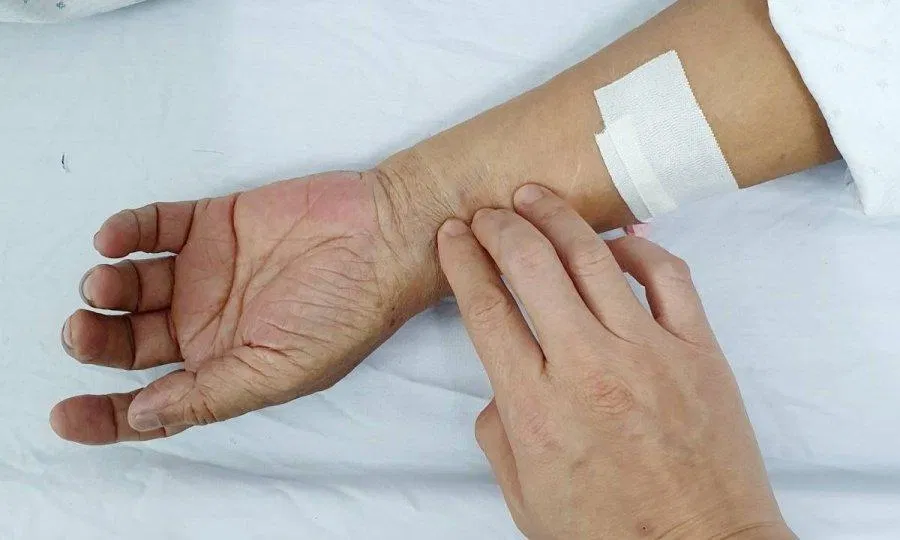 Đếm số mạch đập trong một phút (Ảnh: Internet). Đếm số mạch đập trong một phút (Ảnh: Internet).