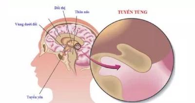 Tuyến tùng có kích thước rất nhỏ nằm sâu trong não (Ảnh: Internet). Tuyến tùng có kích thước rất nhỏ nằm sâu trong não (Ảnh: Internet).