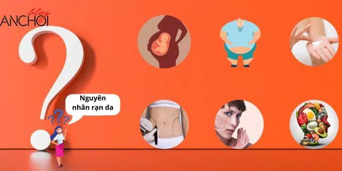 Các nguyên nhân dễ gây nên tình trạng rạn da ( Nguồn: BlogAnChoi)
