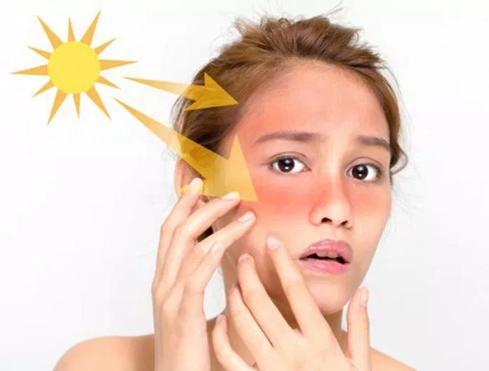 Ánh nắng mặt trời ảnh hưởng trực tiếp đến làn da (Nguồn: Internet)