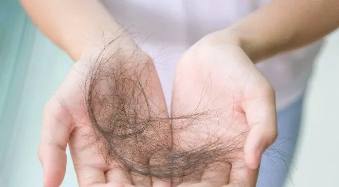 Lạm rụng tẩy tế bào chết quá nhiều khiến tóc rụng và khó mọc lại (Nguồn: Internet)