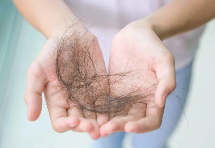 Lạm rụng tẩy tế bào chết quá nhiều khiến tóc rụng và khó mọc lại (Nguồn: Internet)