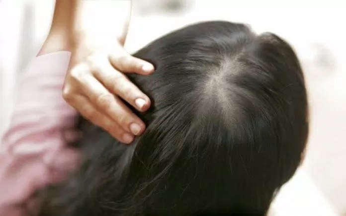 Tẩy da chết cho da đầu thường xuyên sẽ giúp cho mái tóc sạch hơn (Nguồn: Internet)