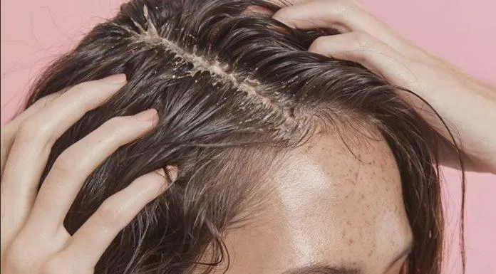Tẩy da chết cho da đầu là việc tác động vật lý bằng các loại hạt lên da đầu (Nguồn: Internet)