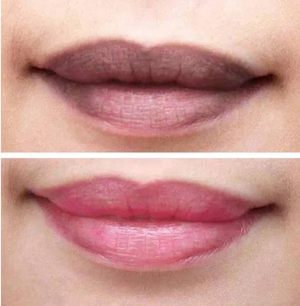 Có rất nhiều nguyên nhân khiến môi bị thâm (Nguồn: Internet)