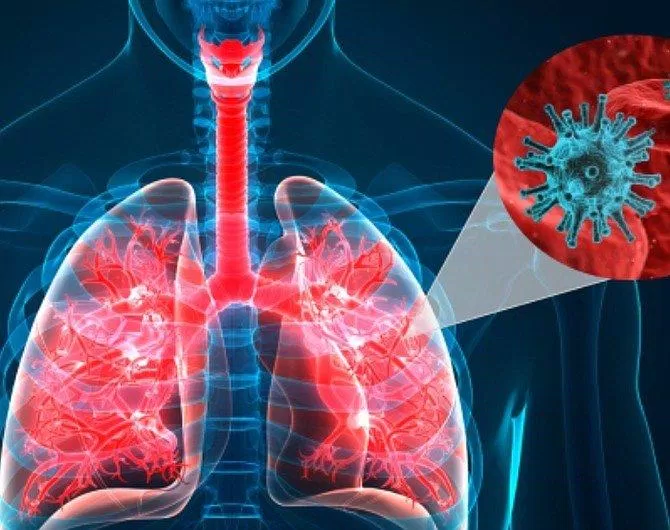 Vaccine dạng hít tạo miễn dịch ngay tại nơi virus xâm nhập (Ảnh: Internet). Vaccine dạng hít tạo miễn dịch ngay tại nơi virus xâm nhập (Ảnh: Internet).