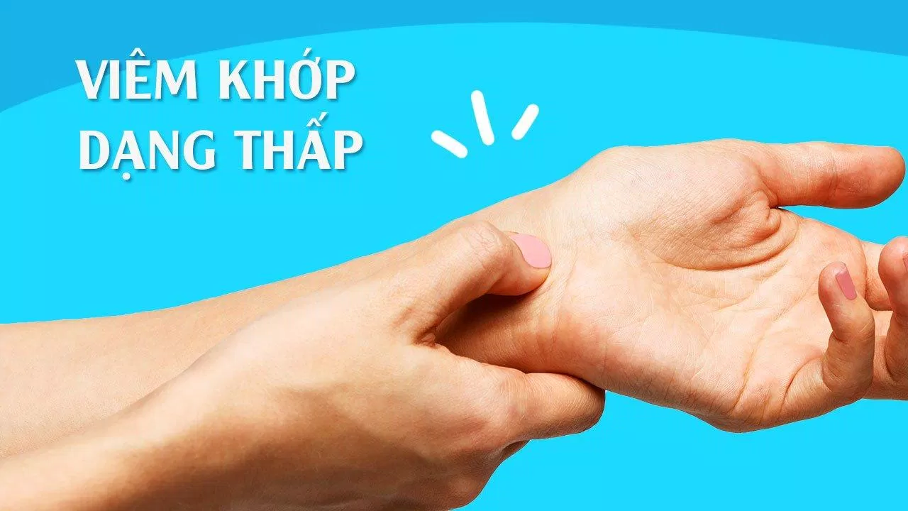 Viêm khớp dạng thấp, căn bệnh khiến hệ miễn dịch tấn công màng hoạt dịch trong khớp (Ảnh: Internet). Viêm khớp dạng thấp, căn bệnh khiến hệ miễn dịch tấn công màng hoạt dịch trong khớp (Ảnh: Internet).