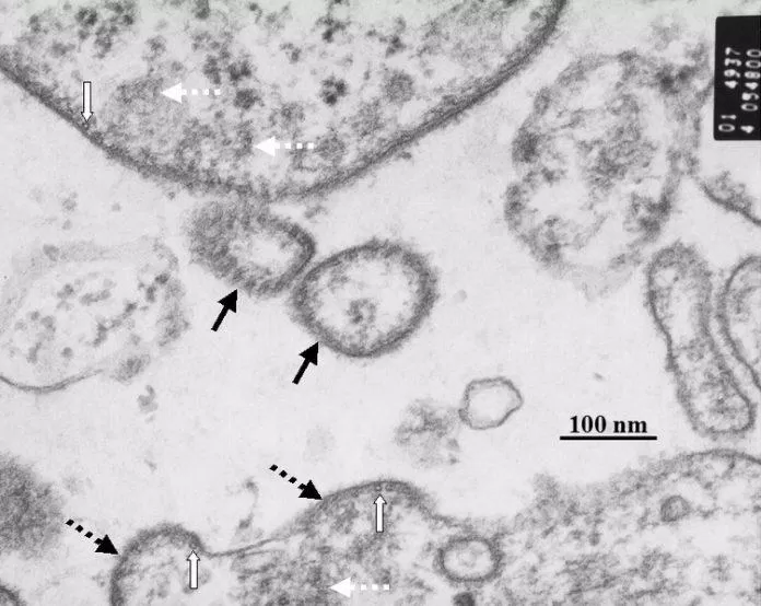 Virus Nipah nhìn dưới kính hiển vi (mũi tên màu đen liền nét) (Ảnh: Internet).