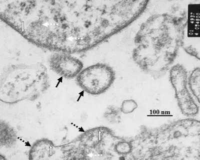 Virus Nipah nhìn dưới kính hiển vi (mũi tên màu đen liền nét) (Ảnh: Internet). Virus Nipah nhìn dưới kính hiển vi (mũi tên màu đen liền nét) (Ảnh: Internet).
