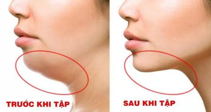 Chăm chỉ luyện tập đánh bay nọng cằm xấu xí đáng ghét (Ảnh: Internet). Chăm chỉ luyện tập đánh bay nọng cằm xấu xí đáng ghét (Ảnh: Internet).