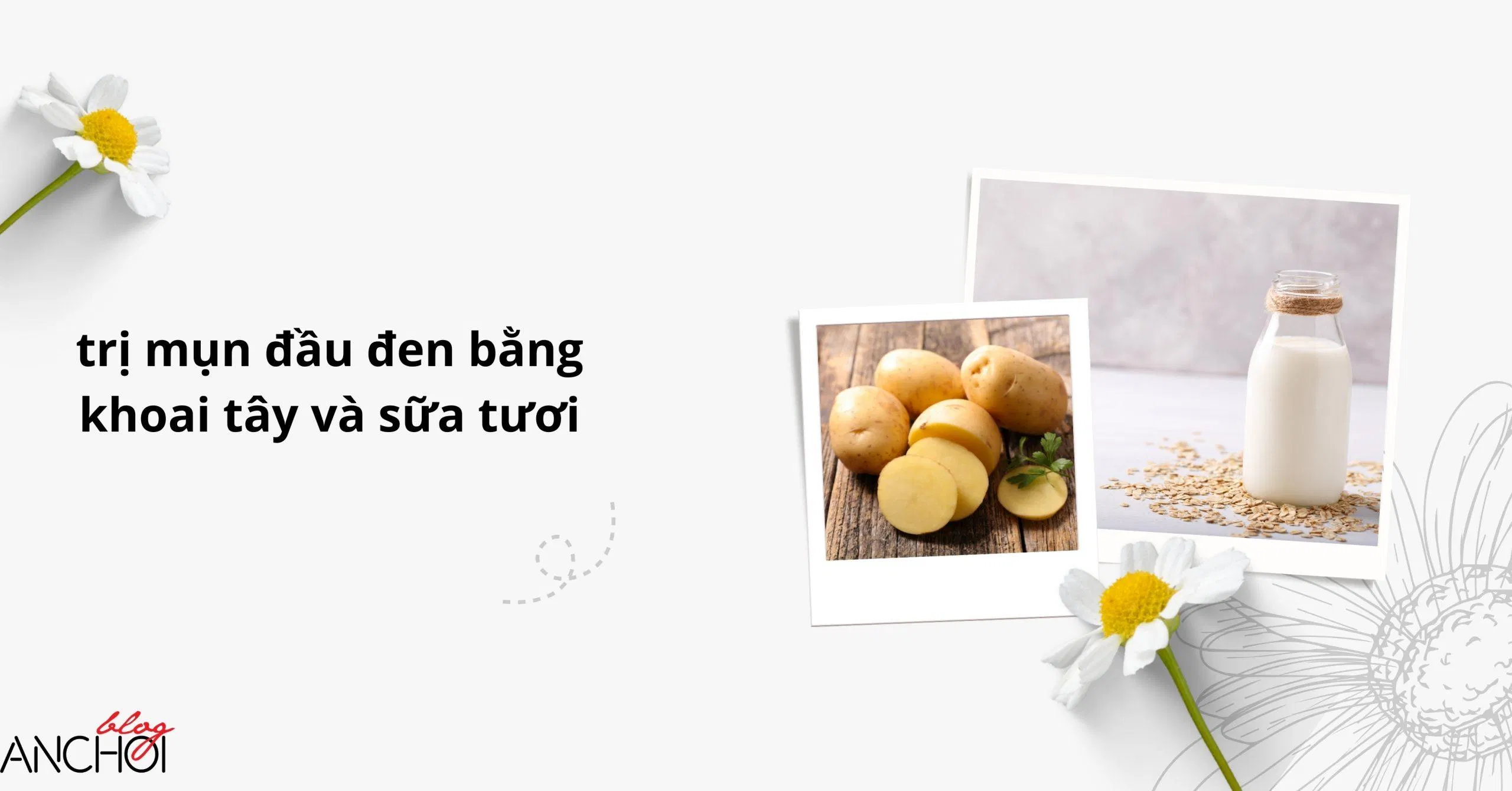 Bạn vẫn có thể kết hợp khoai tây và sữa tươi để trị mụn đầu đen nữa đấy ( Nguồn: BlogAnChoi)