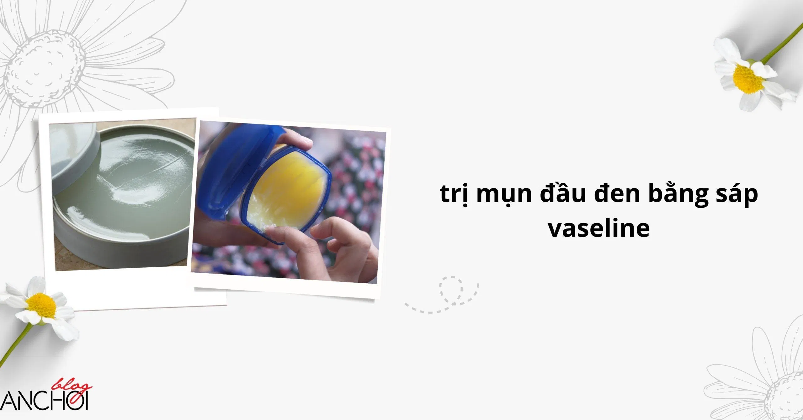 Trị mụn đầu đen bằng sáp vaseline là phương pháp mới được các cô nàng áp dụng gần đây ( Nguồn: BlogAnChoi)