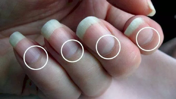 Liềm móng là phần màu trắng nằm ở gốc móng (Ảnh: Internet). Liềm móng là phần màu trắng nằm ở gốc móng (Ảnh: Internet).
