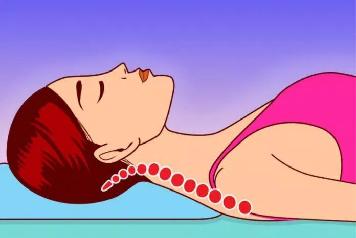 Cột sống cổ phải thẳng trong khi nằm ngủ (Ảnh: Internet). Cột sống cổ phải thẳng trong khi nằm ngủ (Ảnh: Internet).