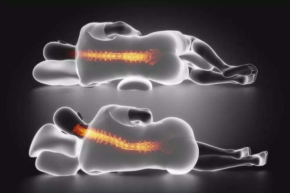 Dùng gối có độ cao phù hợp khi nằm nghiêng (Ảnh: Internet). Dùng gối có độ cao phù hợp khi nằm nghiêng (Ảnh: Internet).