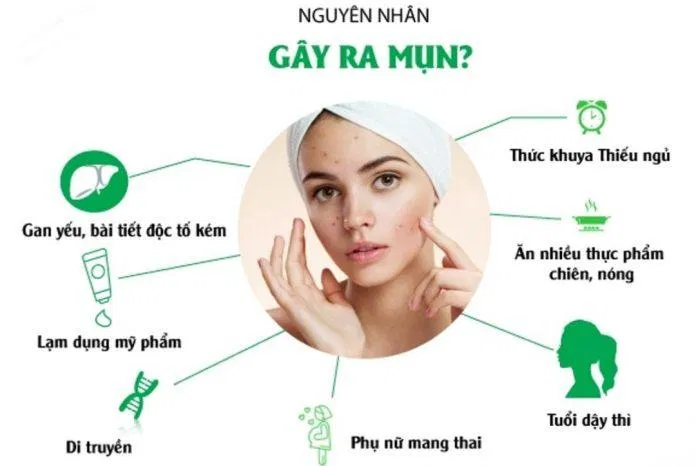 Có rất nhiều nguyên nhân khác nhau gây nên tình trạng mụn (Ảnh: Internet).