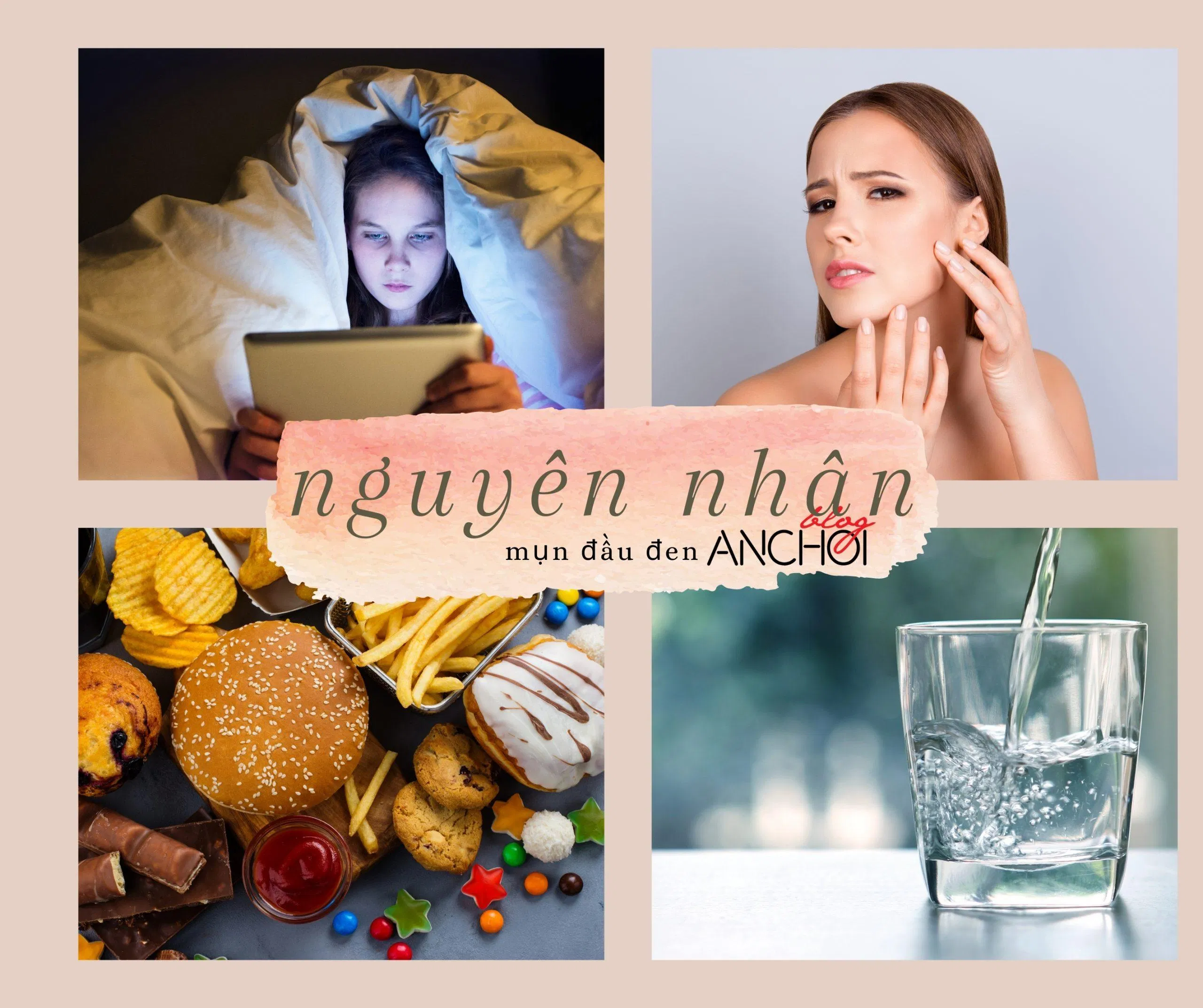Mụn đầu đen xuất hiện có thể do tác động của yếu tố bên trong và bên ngoài của cơ thể ( Nguồn: BlogAnChoi)