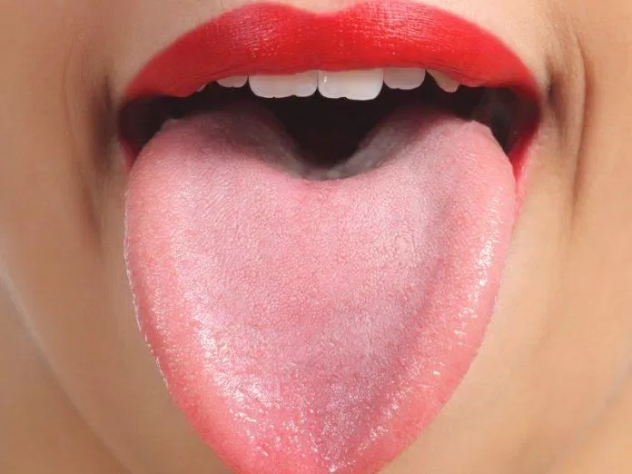 Lưỡi khỏe mạnh có màu hồng và các đốm nhỏ phân bố đều (Ảnh: Internet).
