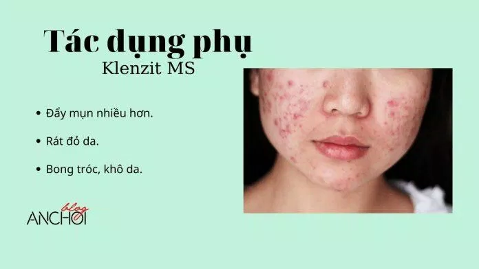 Một số tác dụng phụ không mong muốn khi sử dụng Klenzit MS (Ảnh: nquynhvy)