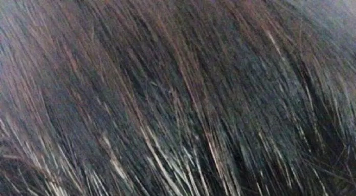 Dầu gội phủ bạc giúp tóc đen nhanh mà không gây hư tổn (Nguồn: Internet)
