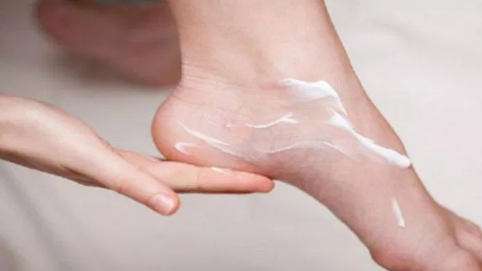 Dùng kem dưỡng ẩm cho bàn chân để tránh khô và ngứa da (Ảnh: Internet).