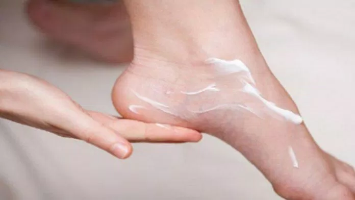 Dùng kem dưỡng ẩm cho bàn chân để tránh khô và ngứa da (Ảnh: Internet). Dùng kem dưỡng ẩm cho bàn chân để tránh khô và ngứa da (Ảnh: Internet).