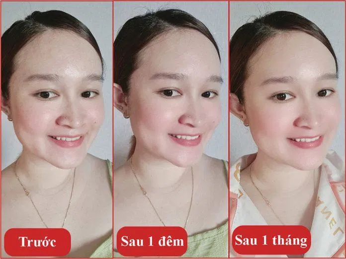 Hiệu quả mang lại trên da sau khi sử dụng kem dưỡng Meder Circa-Night Cream trên da (Nguồn: internet)