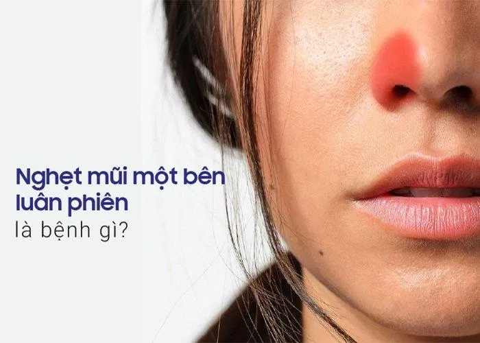 Bạn có bao giờ bị nghẹt mũi đổi bên? (Ảnh: Internet). Bạn có bao giờ bị nghẹt mũi đổi bên? (Ảnh: Internet).