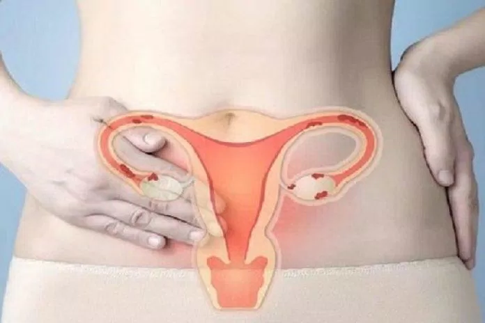Cơn co thắt của tử cung có thể là nguyên nhân gây đau bụng kinh (Ảnh: Internet).