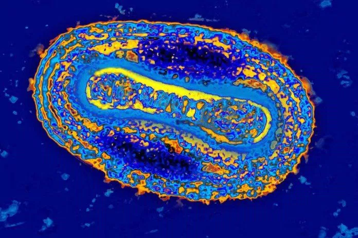 Virus đậu mùa nhìn thấy dưới kính hiển vi điện tử (Ảnh: Internet).