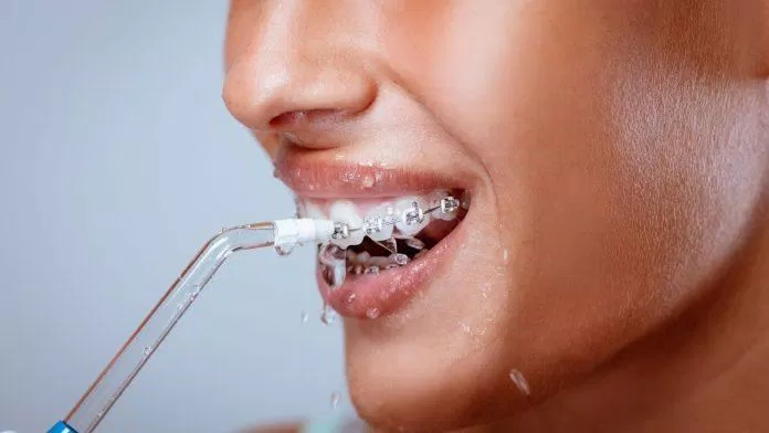 Lựa chọn máy tăm nước rất quan trọng với các bạn đang niềng răng (Nguồn: internet)