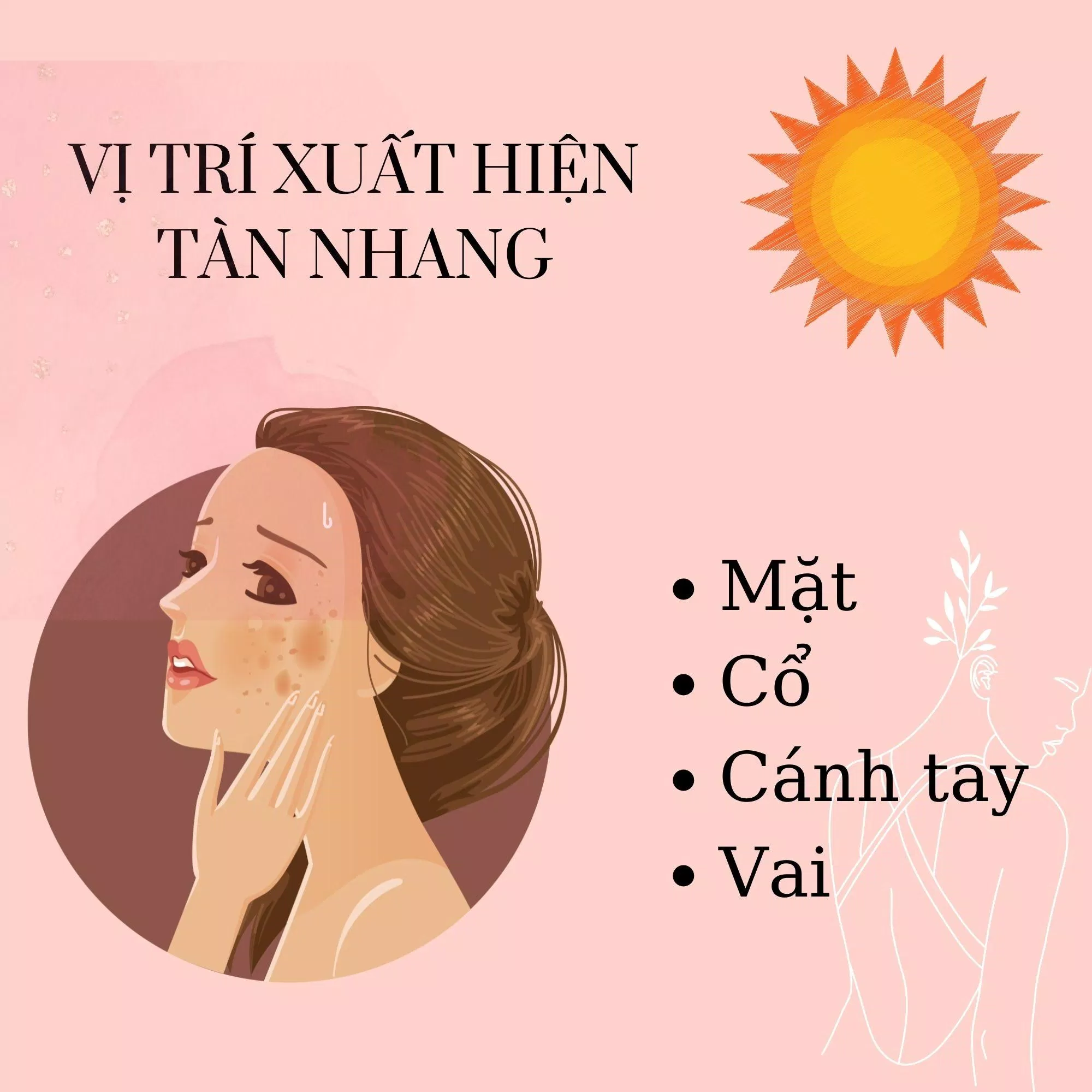 Tàn nhang thường xuất hiện ở những vùng thường xuyên tiếp xúc với ánh mặt trời (Nguồn: BlogAnChoi)