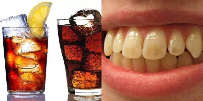 Nước ngọt gây sâu răng và nhiều bệnh nguy hiểm khác (Ảnh: Internet). Nước ngọt gây sâu răng và nhiều bệnh nguy hiểm khác (Ảnh: Internet).
