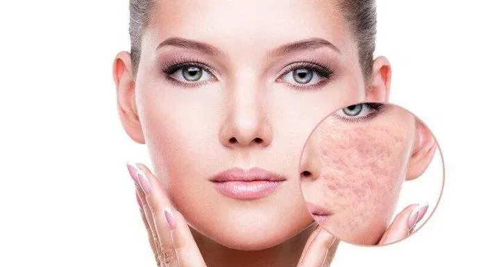 Phương pháp đơn giản, nhanh chóng, hiệu quả tức thì (Nguồn: Internet)