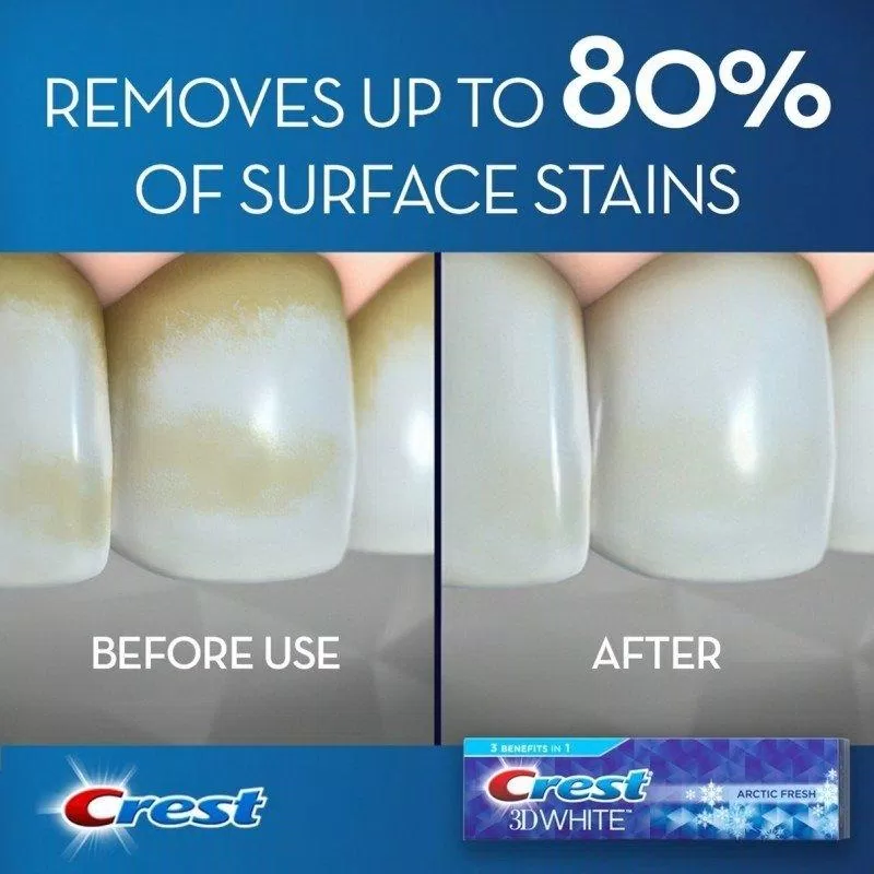 Các dòng kem đánh răng Crest đều được đánh giá cao với khả năng làm trắng răng hiệu quả (ảnh: internet) Các dòng kem đánh răng Crest đều được đánh giá cao với khả năng làm trắng răng hiệu quả (ảnh: internet)