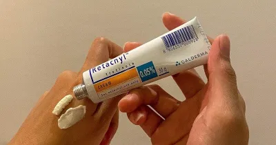 Sản phẩm Retacnyl Cream Tretinoin 0.05% (Nguồn: Internet).