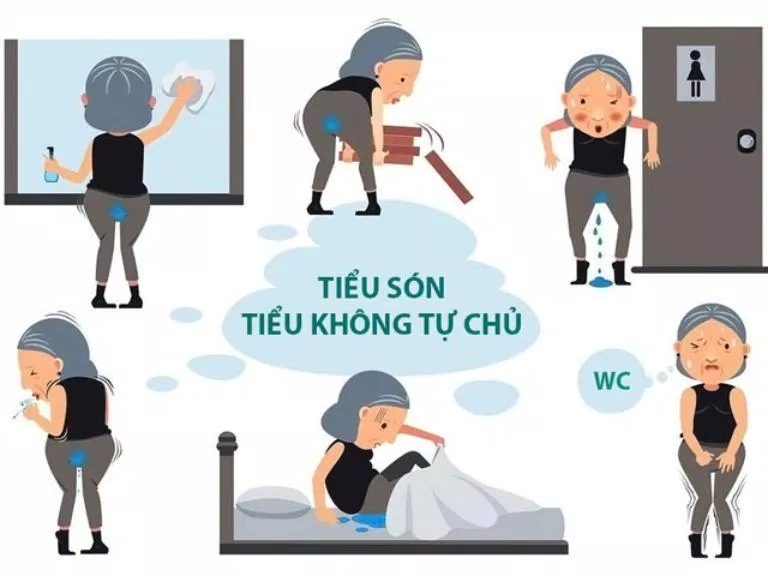 Tiểu són gây rất nhiều phiền toái trong cuộc sống (Ảnh: Internet).