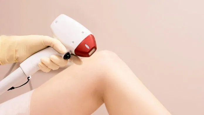 Máy triệt lông là thiết bị làm sạch đám "vi-ô-lông" hiệu quả và đang được các cô nàng ưa chuộng hiện nay (Nguồn: internet)