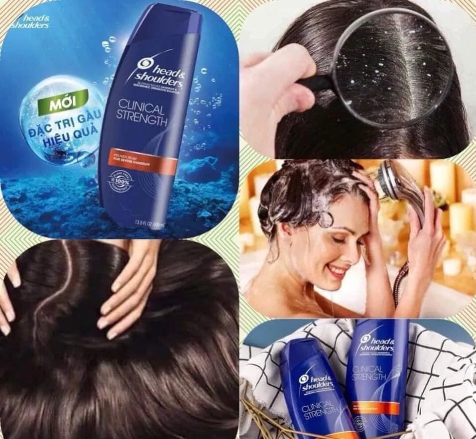 Công dụng tuyệt vời của dầu gội Head And Shoulders Clinical Strength. (Nguồn: internet)