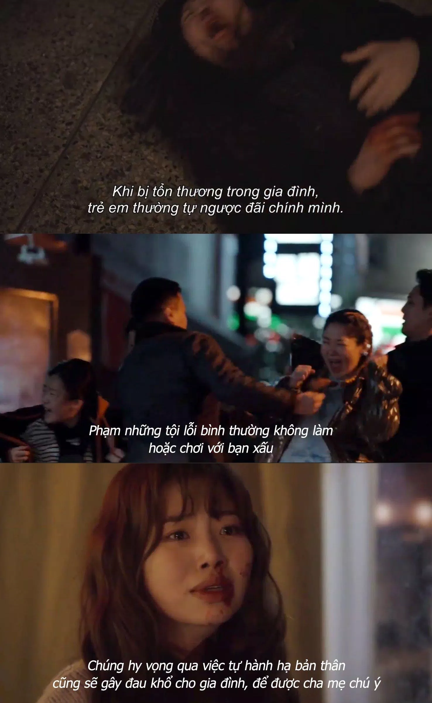 Bởi vì trẻ em bị tổn thương và mong muốn sự chú ý từ người lớn. (Ảnh: BlogAnChoi) Bởi vì trẻ em bị tổn thương và mong muốn sự chú ý từ người lớn. (Ảnh: BlogAnChoi)