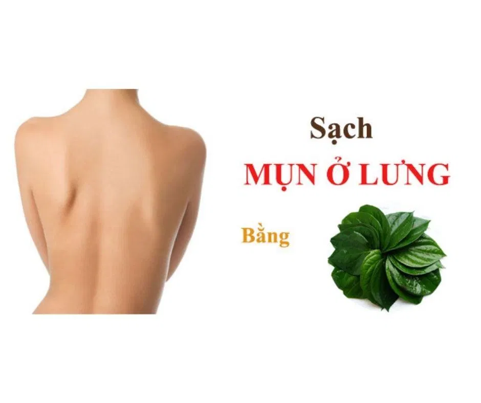 Trị mụn lưng tại nhà bằng lá trầu không (Ảnh: Internet)