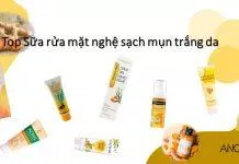 Top sữa rửa mặt nghệ trị mụn dưỡng sáng da tốt nhất hiện nay (Ảnh: nquynhvy)