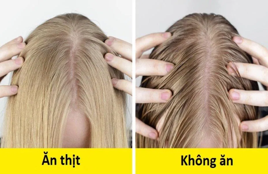 Nguyên nhân của tình trạng này là thiếu kẽm (Ảnh: Internet) Nguyên nhân của tình trạng này là thiếu kẽm (Ảnh: Internet)