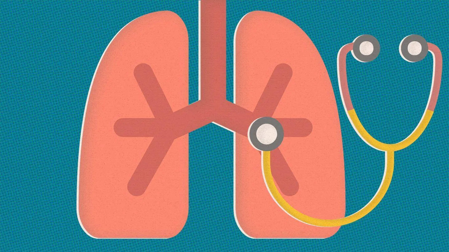 Đau ngực do bệnh lý đường hô hấp (Nguồn: Internet). Đau ngực do bệnh lý đường hô hấp (Nguồn: Internet).