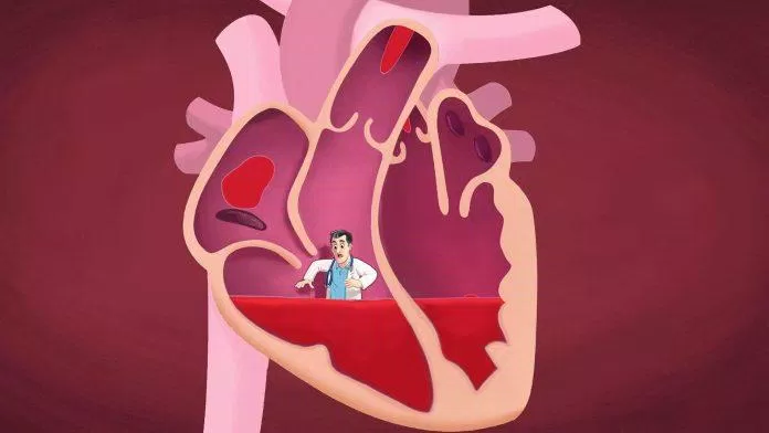 Đau ngực trái do bệnh tim (Nguồn: Internet).