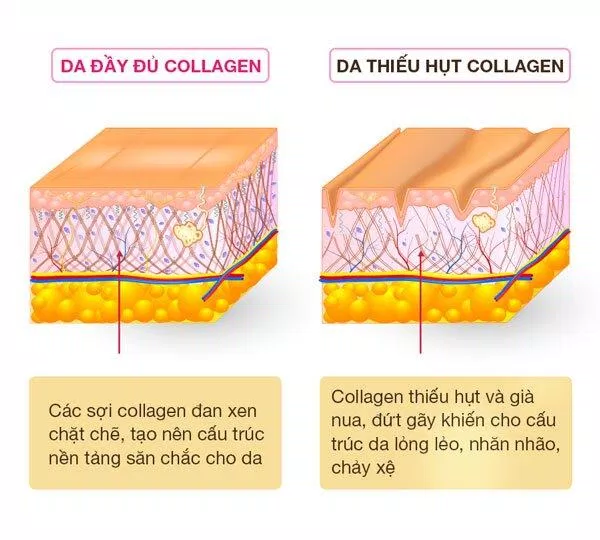 Bổ sung collagen giúp da săn chắc (Nguồn: Internet).