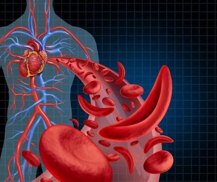 Kombucha còn giúp cải thiện các bệnh lý liên quan đến tim mạch như giảm LDL, tăng HDL (nguồn: internet)